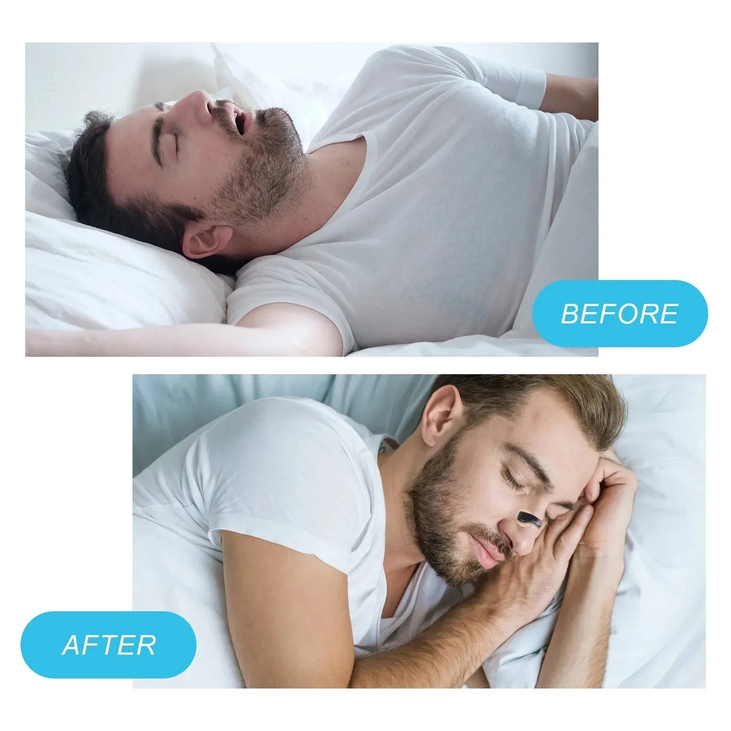 Näsvidgare (30-dagars)